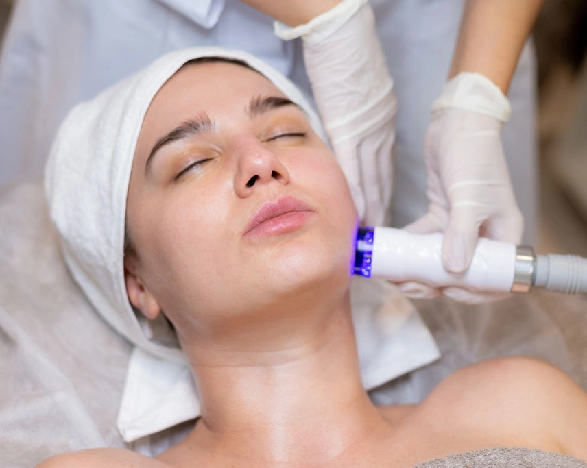 Microneedling-RF-treatment (1)