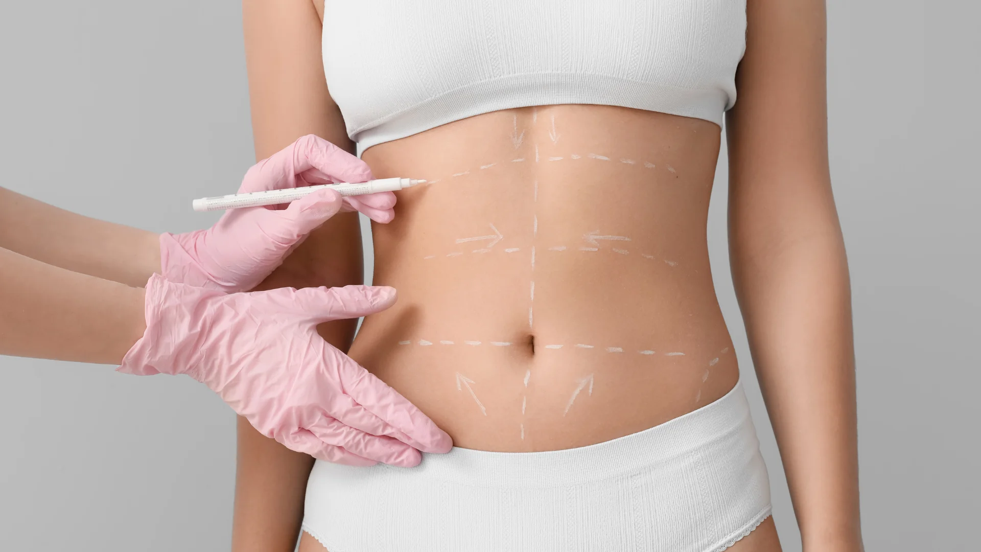360 Liposuction + Tummy Tuck (Abdominoplasty) for Total Torso Contouring in Coimbatore - Ko Cosmetic Surgery Centre