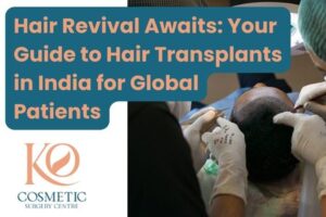 Hair Revival Awaits Your Guide to Hair Transplants in India for Global Patients