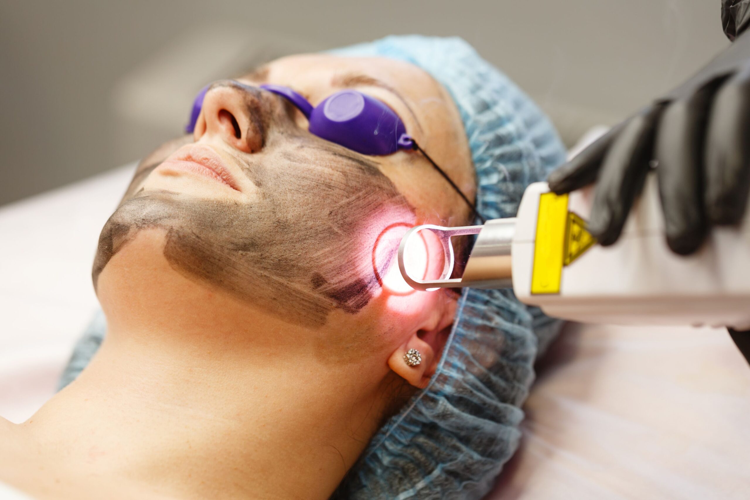 Low-Level Laser Therapy provide by Ko cosmetic surgery centre