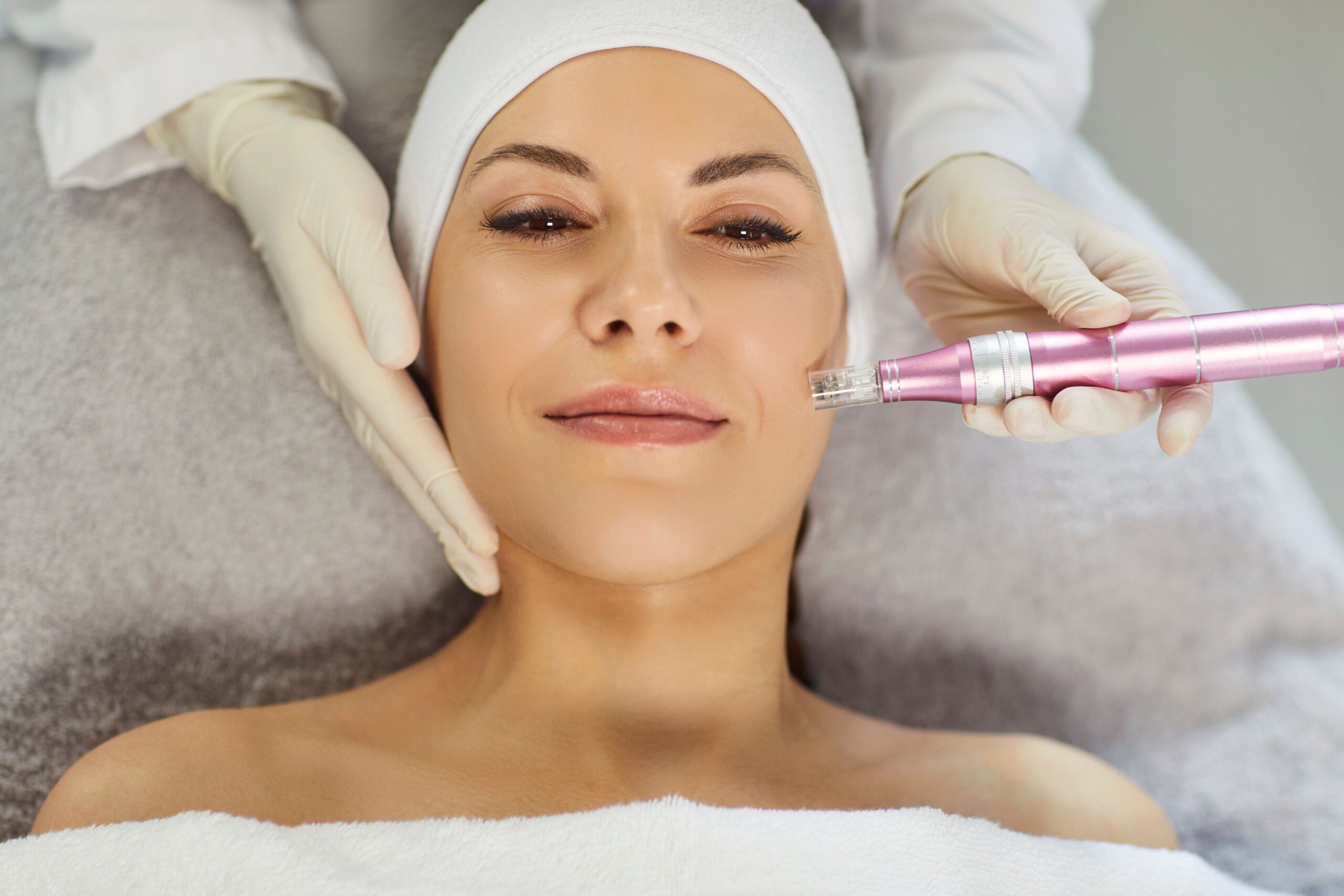 Microneedling RF Treatment provide by Ko cosmetic surgery centre