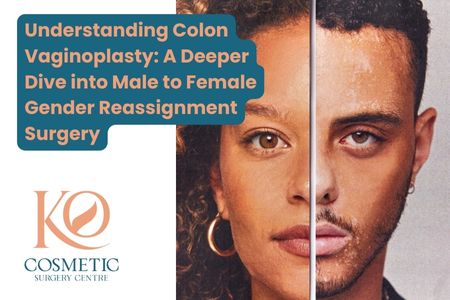 Understanding Colon Vaginoplasty A Deeper Dive into Male to Female Gender Reassignment Surgery provide by Ko cosmetic surgery centre in Coimbatore
