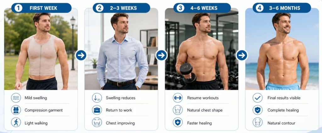 Gynecomastia surgery recovery timeline showing healing progress from first week to 3–6 months with reduced swelling and improved chest contour at KO Cosmetic Surgery Centre in Coimbatore.