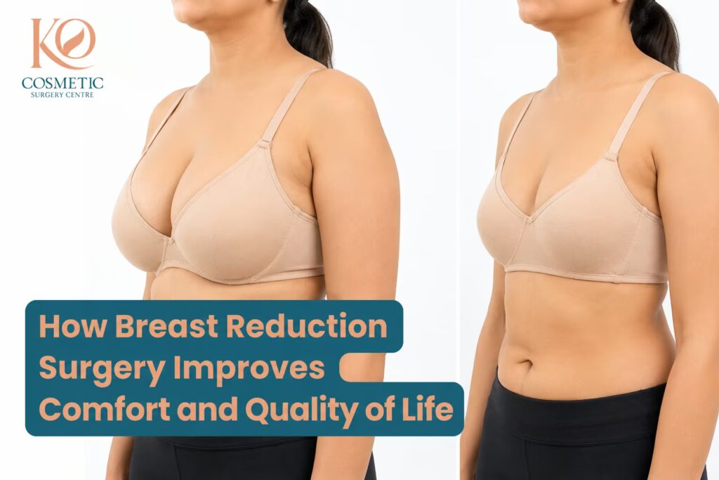 How Breast Reduction Surgery Improves Comfort and Quality of Life